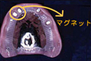 増野歯科医院 精密入れ歯専門サイト