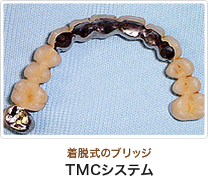 TMCシステム